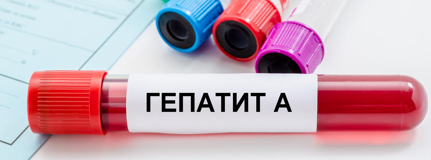 Спалах гепатиту А у Києві: санітарний лікар озвучив ймовірну причину