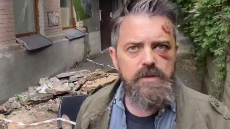 Упав разом з балконом: американський кореспондент уточнив деталі інциденту у Києві та показав відео