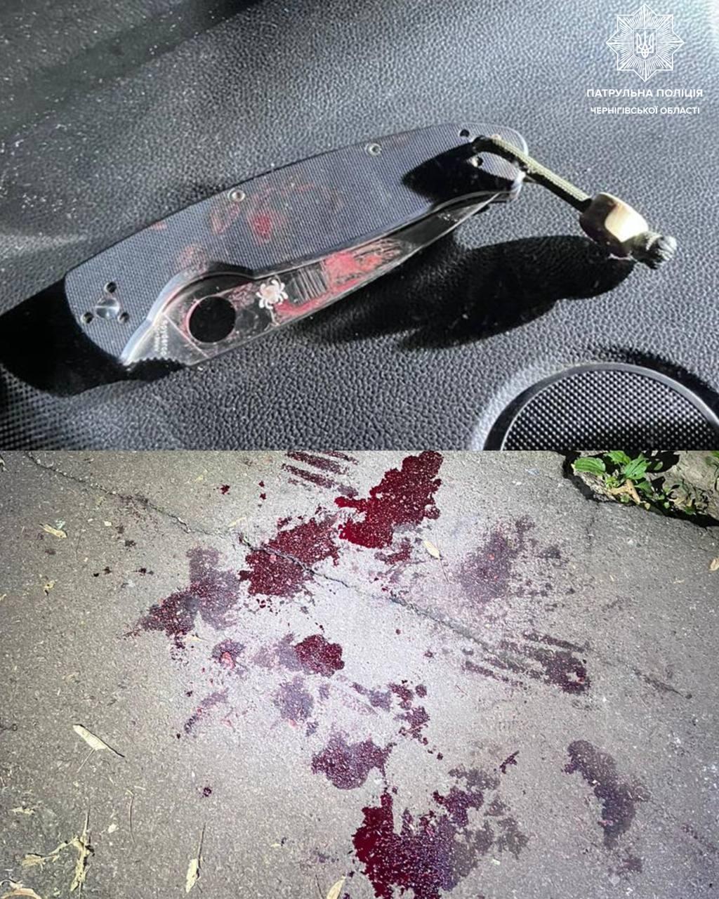 У Чернігові чоловік кидався на людей з ножем