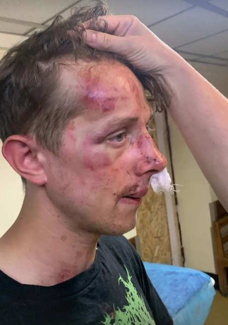 У Києві побили ветерана війни