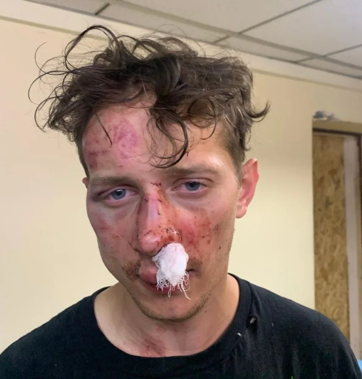 У Києві побили ветерана війни