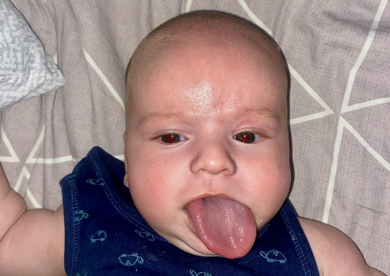в охматдиті малюку вкоротили язика